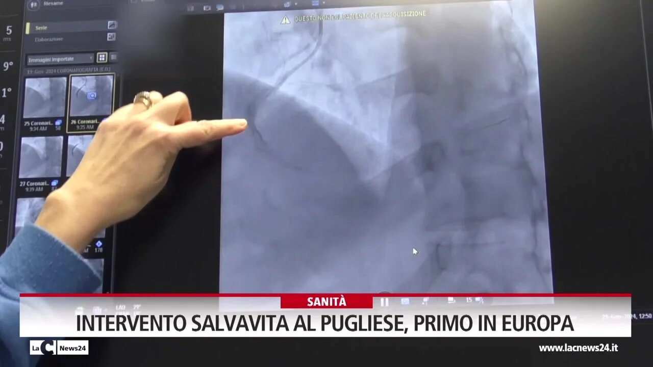 Intervento salvavita al Pugliese, primo in Europa