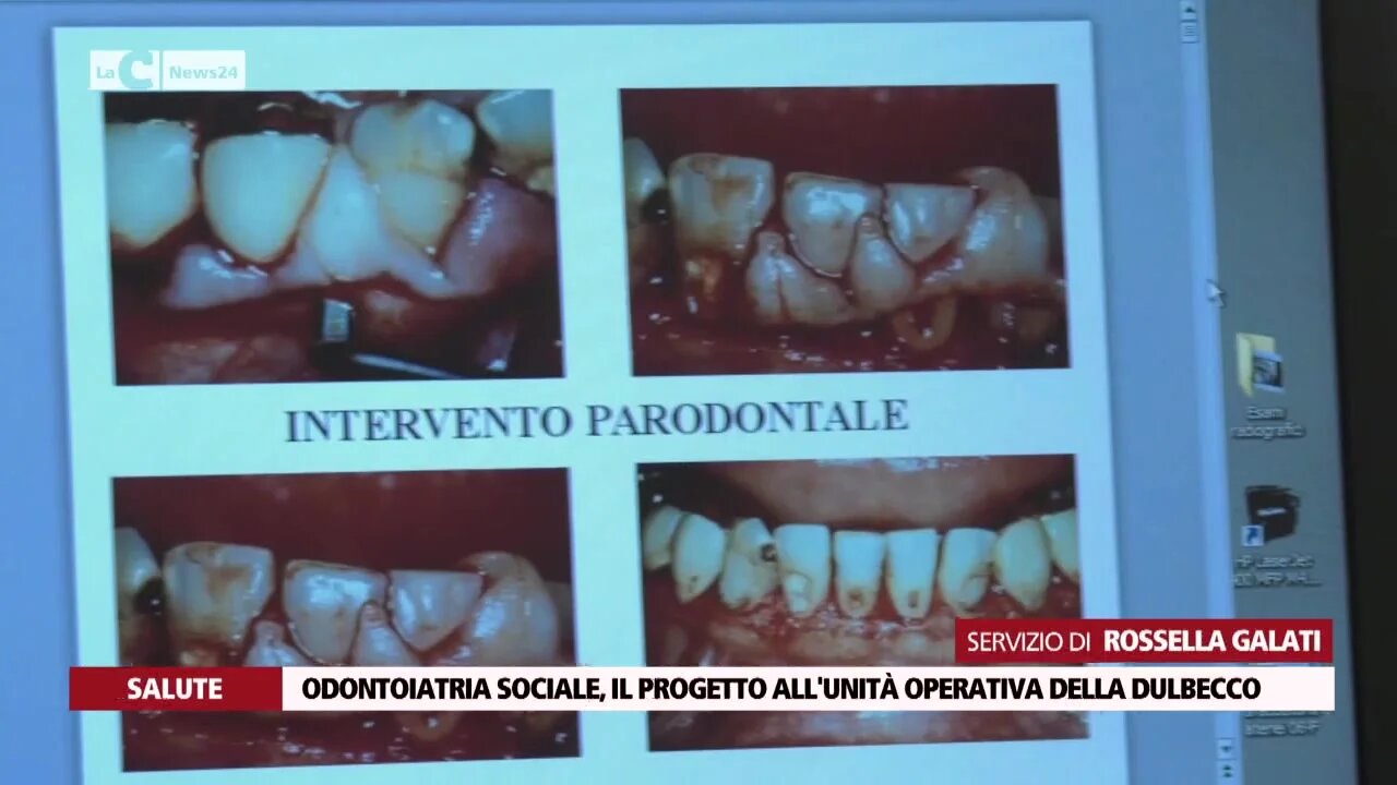 Odontoiatria sociale, il progetto all'unita operativa della Dulbecco